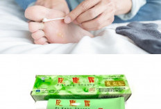Obat Kutu Air Paling Ampuh untuk Anak dan Dewasa