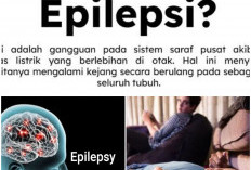 Mitos Atau Fakta Kesurupan Adalah Epilepsi? Berikut Fakta Mengenai Kesurupan yang Sering Disalah Artikan