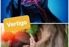 Kenali Penyebab dan Gejalanya. Ternyata Begini Mengobati Vertigo