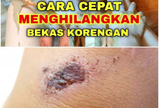 Hilang Permanen? Begini Cara Alami Hilangkan Bekas Koreng dan Borok yang Menghitam. Penasaran Kan?