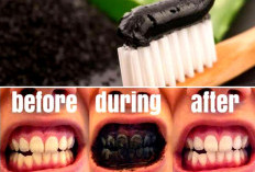 Gigi Seketika Putih dan Kinclong! Benarkah Arang Bisa Memutihkan dan Membersihkan Gigi?