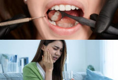 Tak Perlu Cemas, Inilah 4 Cara Mengatasi Sakit Gigi Dengan Perawatan Sederhana di Rumah