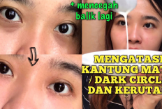 Lihat Perbedaannya! 9 Cara Ampuh Mengatasi Kantung Mata dan Lingkar Hitam Tanpa Perlu Obat!