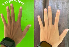 Tanpa Filter Berat, Ini Cara Bikin Foto Tetap Estetik dan Natural