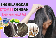 Rahasia Menghilangkan Ketombe Tanpa Obat Kimia, Nomor 3 Paling Ampuh!