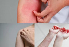 5 Cara Alami Mengatasi Alergi Dingin dan Debu yang Ampuh