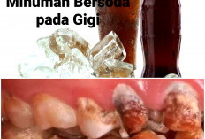 Stop Sekarang! Ini Dampak Negatif Jika Kamu Keseringan Minum Soda