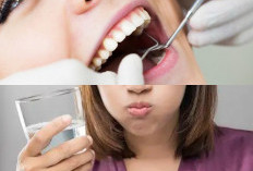 Mau Bebas dari Sakit Gigi? Lakukan 5 Cara Efektif Untuk Mengatasi Sakit Gigi yang Terus Menerus