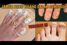 Ampuh! Cara Mengatasi Jamur Kuku Kaki Secara Alami dan Cepat!