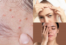 Bruntusan di Wajah? Jangan Khawatir Ini 7 Langkah Mudah Untuk Mengatasinya