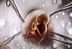 Bahaya aborsi dengan obat Cytotec, Ini Akibatnya