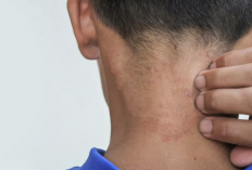 7 Kebiasaan Sederhana yang Bisa Mengusir Kudis & Kurap dalam Sekejap!