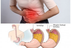 Maag Datang Mendadak? Ini Tanda-Tanda yang Perlu Diwaspadai dan Cara Meredakannya