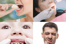 Tips Ampuh Mengatasi Gigi Berlubang Tanpa Rasa Sakit, Perawatan dan Pengobatan yang Efektif!
