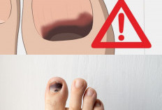 Kuku Kaki Hitam dan Tebal? Begini Cara Mengatasinya di Rumah Tanpa Harus ke Klinik!