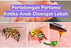 Yang Harus Dilakukan Jika Anak Tersengat Lebah