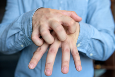 Jangan Biarkan Kudis Menghantui Tangan Anda! Ini Cara Cerdas Menghindarinya!