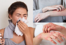 Jangan Panik Saat Kamu Alergi Dingin, Ini 6 Cara Mengatasi dan Mencegahnya!