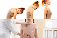Ingin Rahasia Postur Tegak? Inilah 5 Tips Praktis Untuk Mencegah Badan Bungkuk
