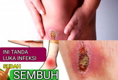 Jangan Khawatir, 4 Tanda Luka Akan Segera Sembuh dan Tahapannya