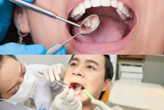 Tak Usah Khawatir! Ini 5 Tips Langkah Sederhana Untuk Mengobati Gigi Berlubang Secara Efektif