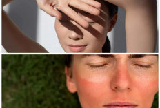 7 Tips Praktis Mengatasi Kulit Wajah Belang agar Tampak Cerah, Sehat, dan Lebih Glowing