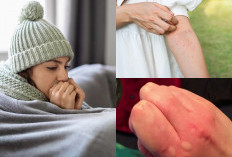 Tak Perlu ke Dokter, Ternyata Ini 7 Langkah-langkah Ampuh Mengatasi Alergi Dingin yang Mengganggu