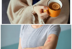 Alergi Dingin Sering Kambuh? Coba 5 Cara Mudah Ini untuk Meredakannya Secara Alami