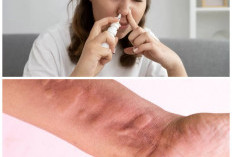 Jangan Terus Ketergantungan Obat, Ini 5 Cara Alami Paling Ampuh yang Wajib Dicoba!