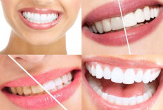Mau Gigi Anda Putih? Lakukan 5 Tips Langkah Untuk Gigi Putih yang Memukau