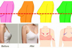 6 Penyebab Payudara Kendur dan Tampak Melorot