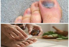 Kuku Kaki Hitam dan Menebal? Ini 7 Cara Mudah Mengatasinya di Rumah Tanpa Biaya Mahal
