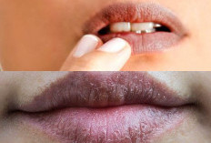 Mau Tahu Rahasia Cantik: Ini Dia 7 Tips Mencerahkan Bibir yang Gelap dan Kusam