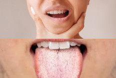 Lidah Pahit Saat Sakit? Inilah 6 Tips Alami Menghilangkan Rasa Pahit di Mulut 