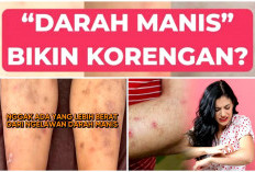 Korengan Karena Darah Manis? Kenali Prurigo, Gatal Hebat yang Bikin Bekas Luka Sulit Hilang