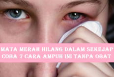 Mata Merah? Jangan Panik, Ini Cara Cepat Mengatasi Tanpa Obat yang Wajib Kamu Coba!