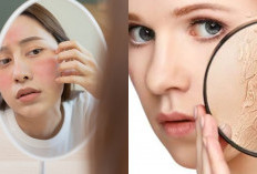 Kulit Kering Akibat Cuaca? Yuk Cobain 6 Tips Perawatan yang Wajib Dicoba