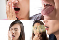 Nafas Anda Tak Sedap? Ternyata Ini 5 Tips Kesehatan Mulut Bebas Bau Mulut Sepanjang Hari