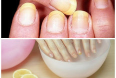 7 Tips Ampuh Memutihkan Kuku yang Kuning Agar Kembali Bersih dan Berkilau!