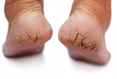 Terungkap! Rahasia Merawat Kaki Agar Selalu Lembut Tanpa Kerutan atau Pecah-Pecah
