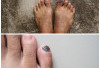 Rahasia Mengatasi Kuku Kaki Hitam dan Tebal Tanpa Harus Bayar Mahal ke Klinik!