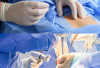 Operasi Tulang Belakang,  Yang Perlu Anda Ketahui Sebelum Memutuskan
