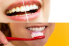 Ingin Gigi Putih Alami, Lakukan 5 Tips Ampuh Untuk Senyum yang Memikat