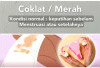 Keputihan Cokelat: Normal atau Tanda Bahaya? Kenali Penyebab dan Kapan Harus Waspada